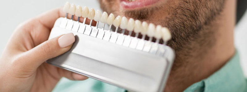 ODM/OEM/ 代工/贴牌（images 4）