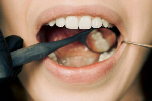 外贸电动牙刷采购策略：加工厂选择指南